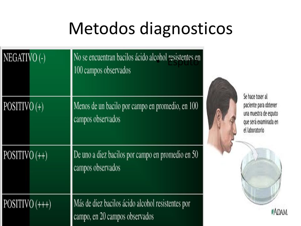Metodos diagnosticos Bacilos copia: 3 muestras en 2 días Esputo