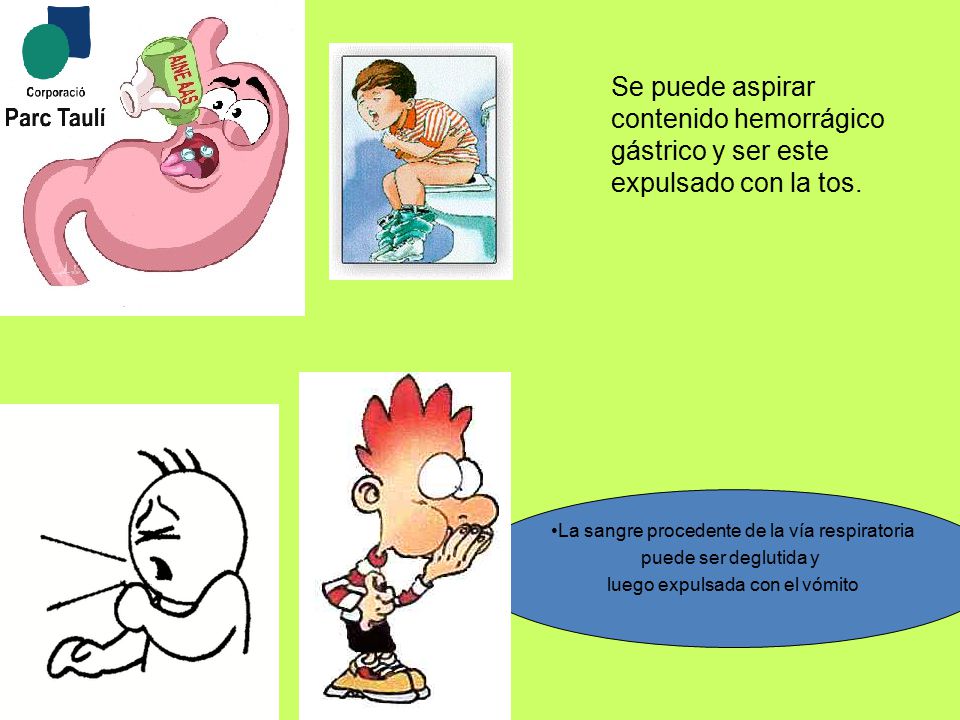 Se puede aspirar contenido hemorrágico gástrico y ser este expulsado con la tos.