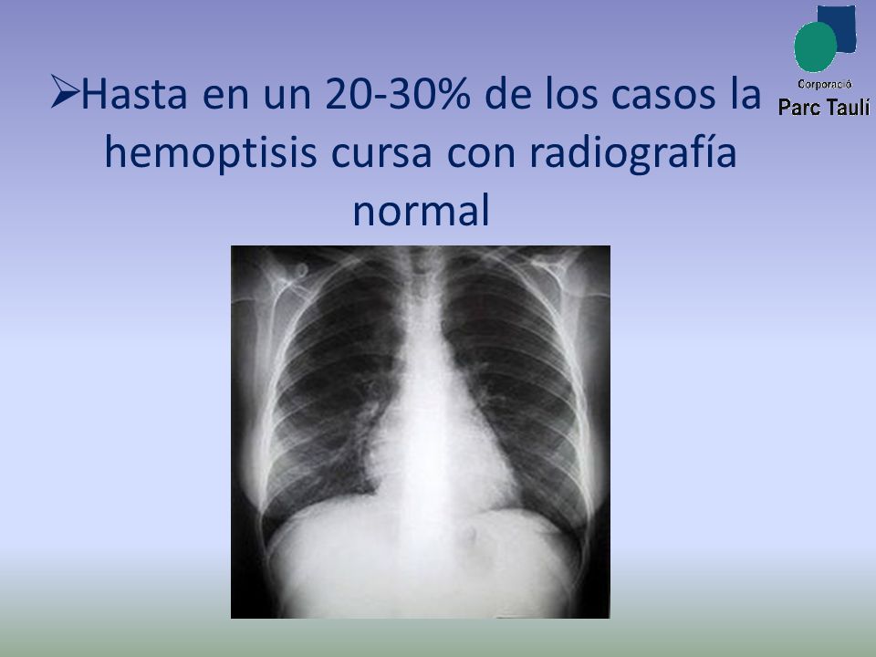 Hasta en un 20-30% de los casos la hemoptisis cursa con radiografía normal