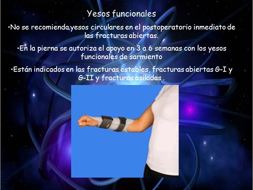 Yesos funcionales No se recomienda yesos circulares en el postoperatorio inmediato de las fracturas abiertas.