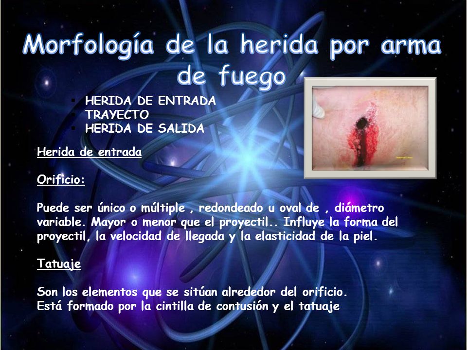 Morfología de la herida por arma de fuego