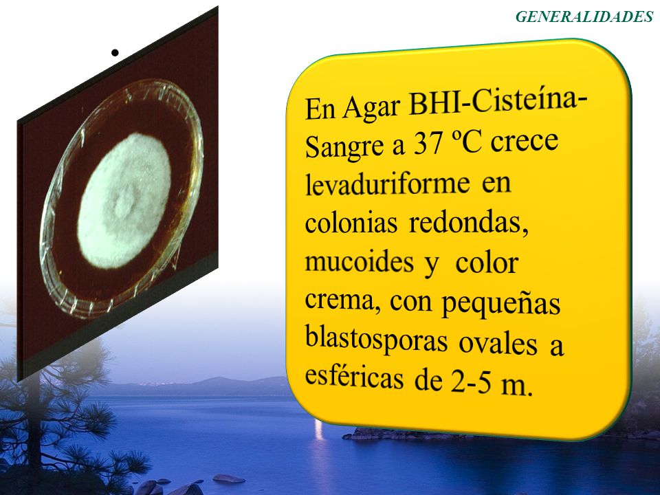 En Agar BHI-Cisteína-Sangre a 37 ºC crece levaduriforme en