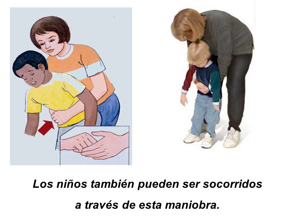 Los niños también pueden ser socorridos a través de esta maniobra.