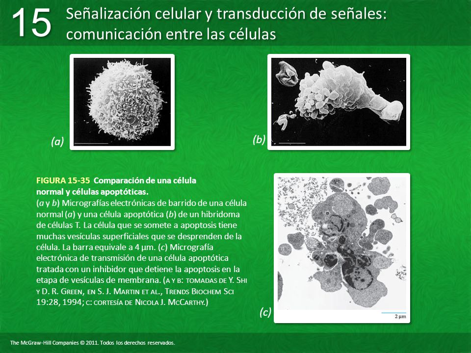 FIGURA Comparación de una célula normal y células apoptóticas.