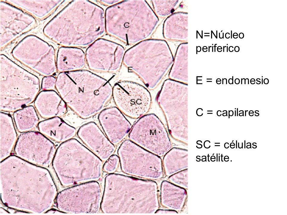 N=Núcleo periferico E = endomesio C = capilares SC = células satélite.