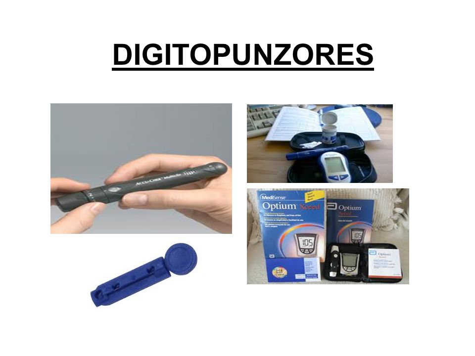 DIGITOPUNZORES