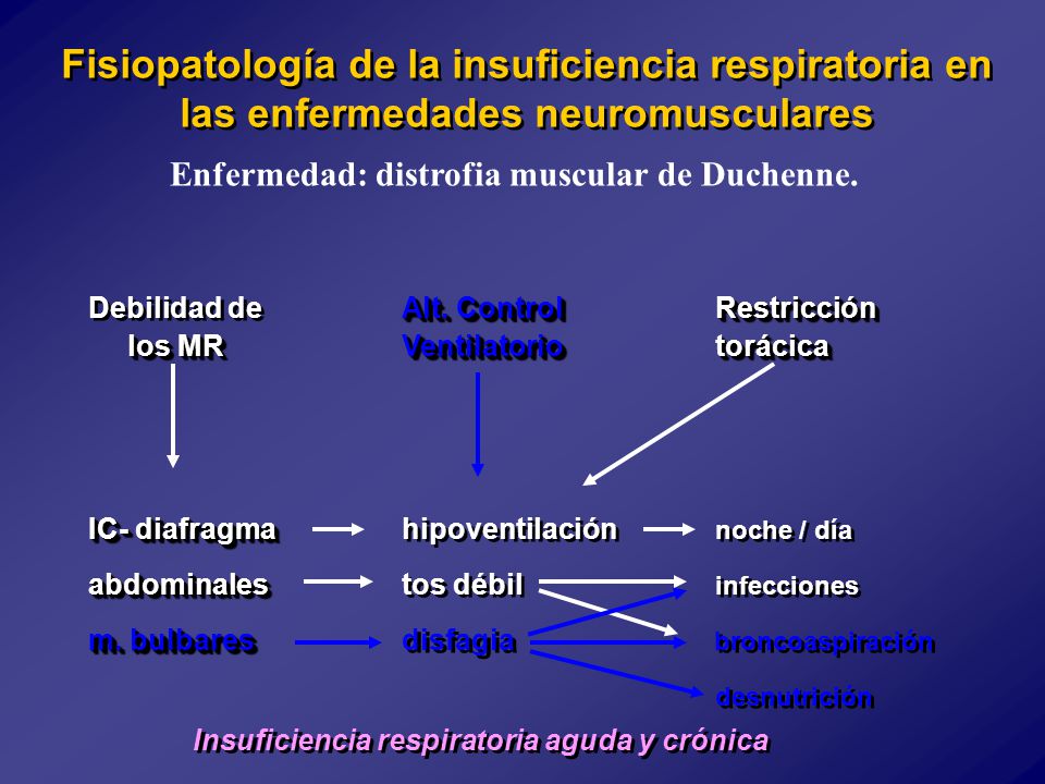 Enfermedad: distrofia muscular de Duchenne.
