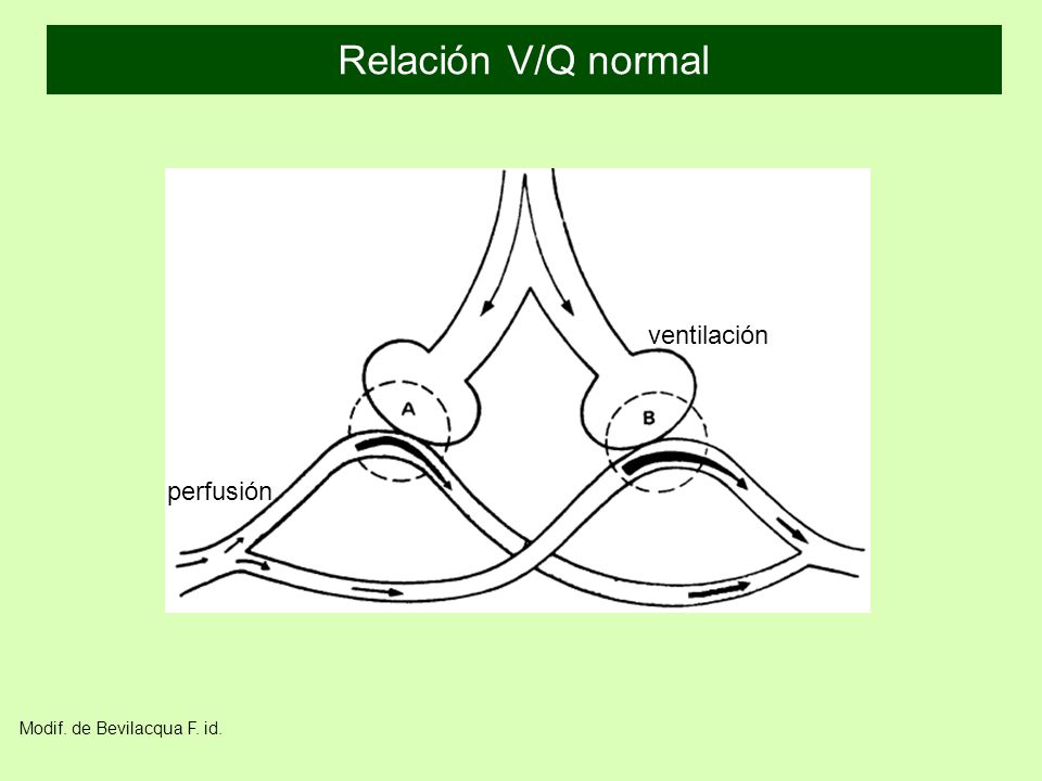 Relación V/Q normal ventilación perfusión Modif. de Bevilacqua F. id.