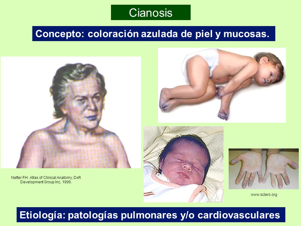 Netter FH: Atlas of Clinical Anatomy, DxR Development Group Inc, 1999.