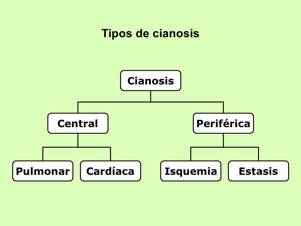 Tipos de cianosis Cianosis Central Periférica Pulmonar Cardíaca