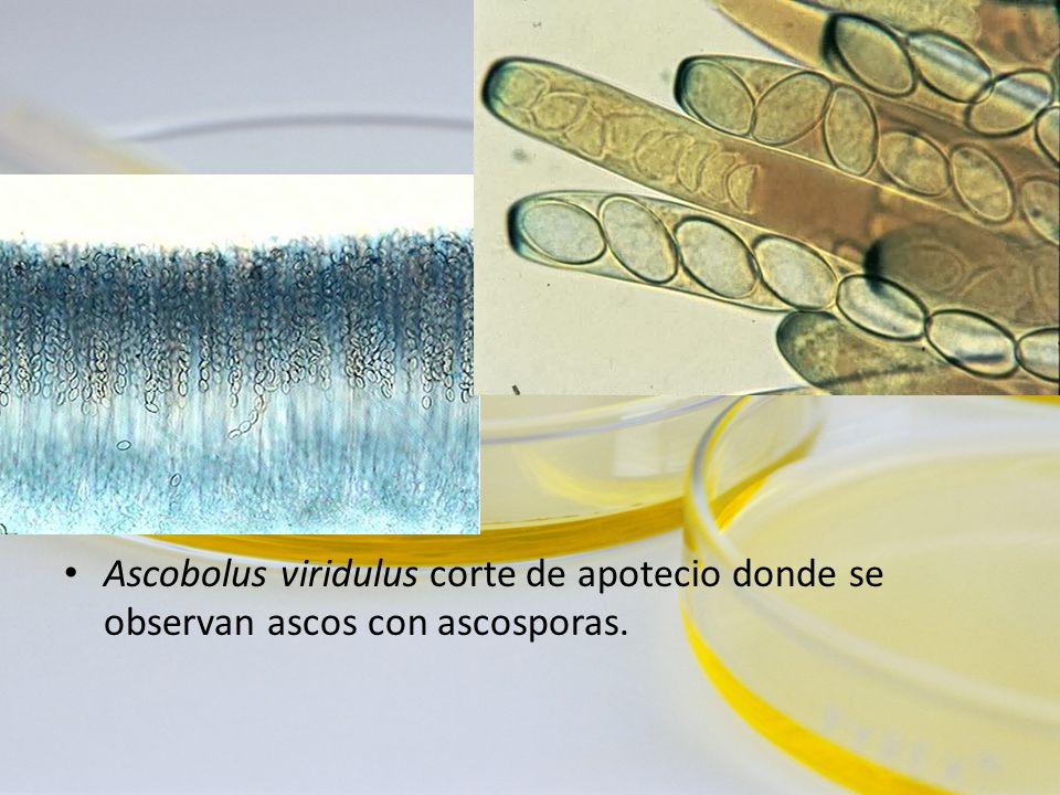 Ascobolus viridulus corte de apotecio donde se observan ascos con ascosporas.