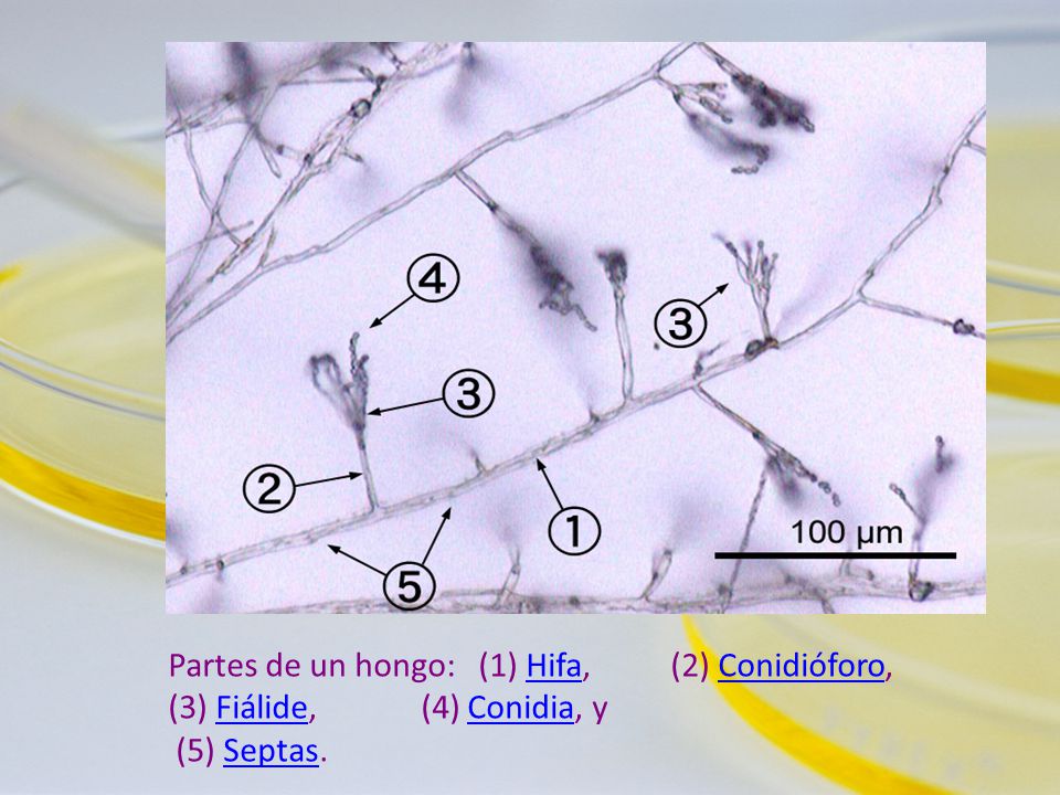 Partes de un hongo: (1) Hifa, (2) Conidióforo, (3) Fiálide, (4) Conidia, y