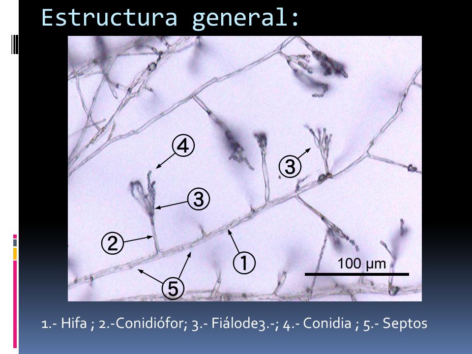 Estructura general: 1.- Hifa ; 2.-Conidiófor; 3.- Fiálode3.-; 4.- Conidia ; 5.- Septos