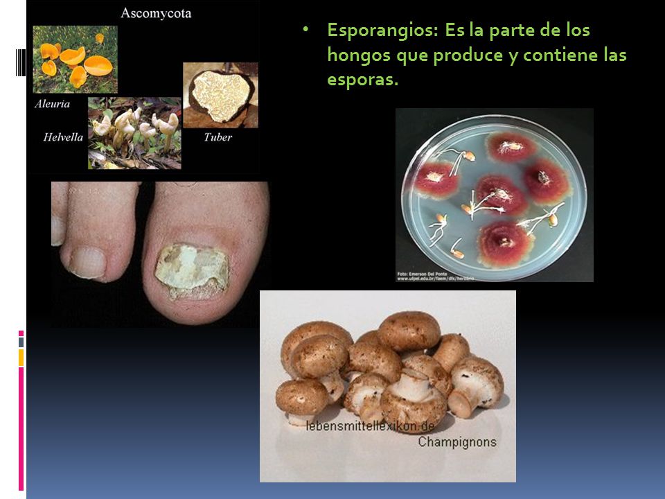 Esporangios: Es la parte de los hongos que produce y contiene las esporas.