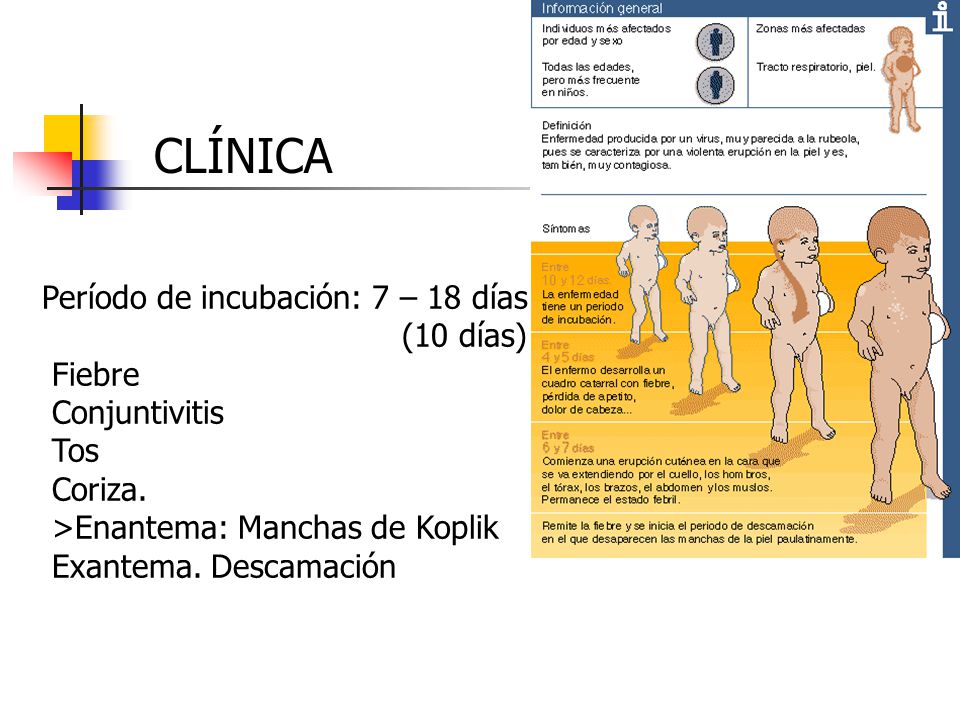 CLÍNICA Período de incubación: 7 – 18 días (10 días) Fiebre