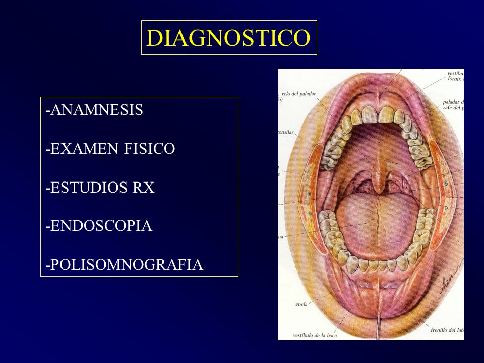 DIAGNOSTICO -ANAMNESIS -EXAMEN FISICO -ESTUDIOS RX -ENDOSCOPIA