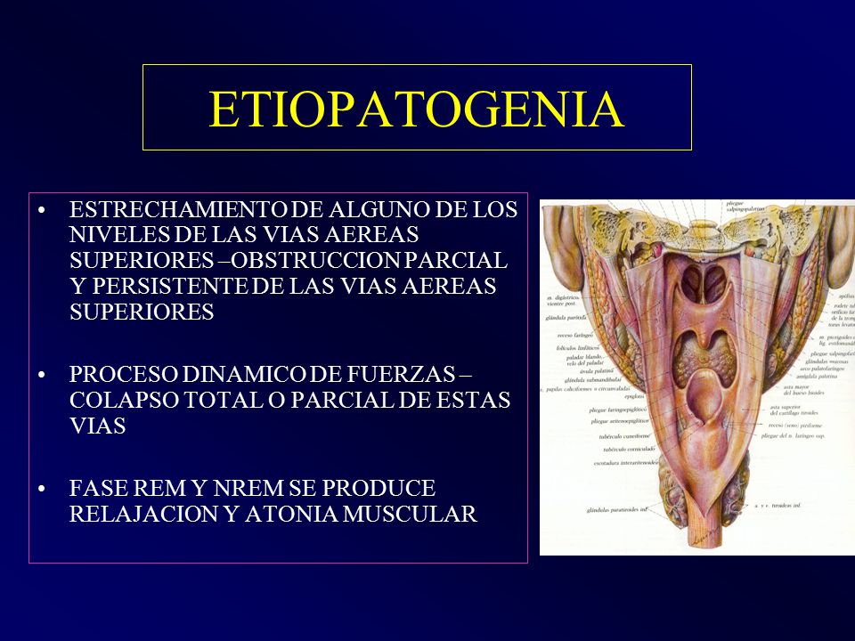 ETIOPATOGENIA ESTRECHAMIENTO DE ALGUNO DE LOS NIVELES DE LAS VIAS AEREAS SUPERIORES –OBSTRUCCION PARCIAL Y PERSISTENTE DE LAS VIAS AEREAS SUPERIORES.