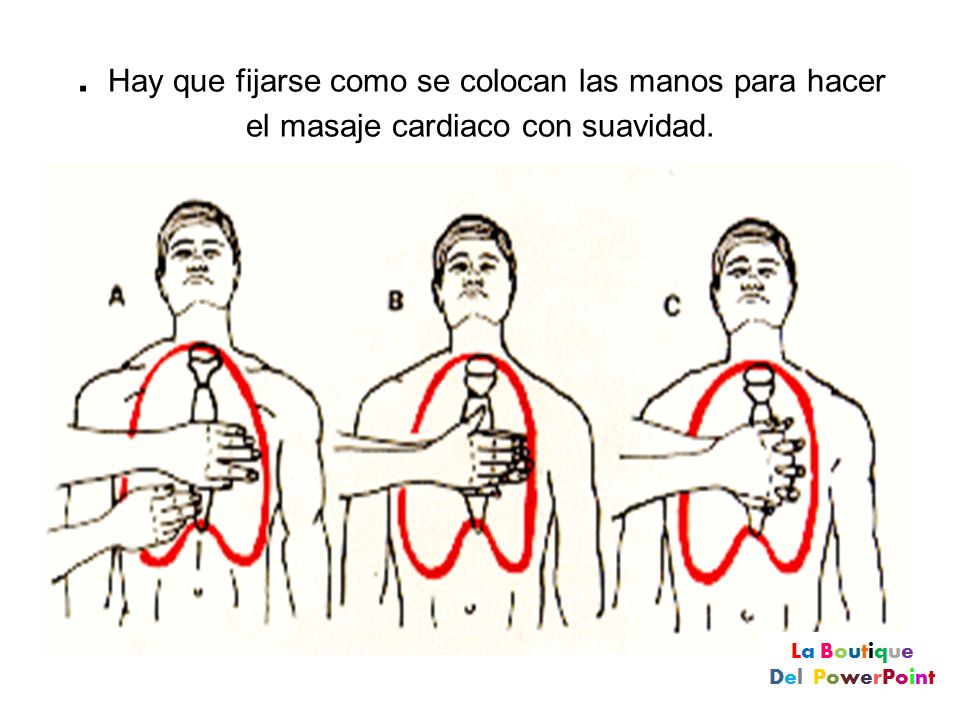 . Hay que fijarse como se colocan las manos para hacer el masaje cardiaco con suavidad.
