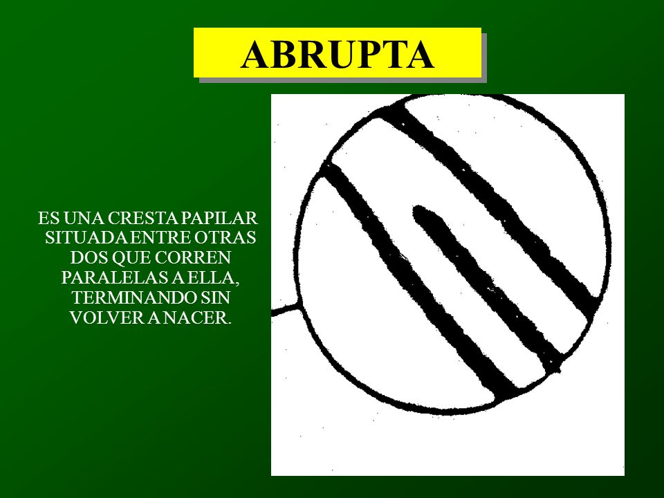ABRUPTA ES UNA CRESTA PAPILAR SITUADA ENTRE OTRAS DOS QUE CORREN PARALELAS A ELLA, TERMINANDO SIN VOLVER A NACER.