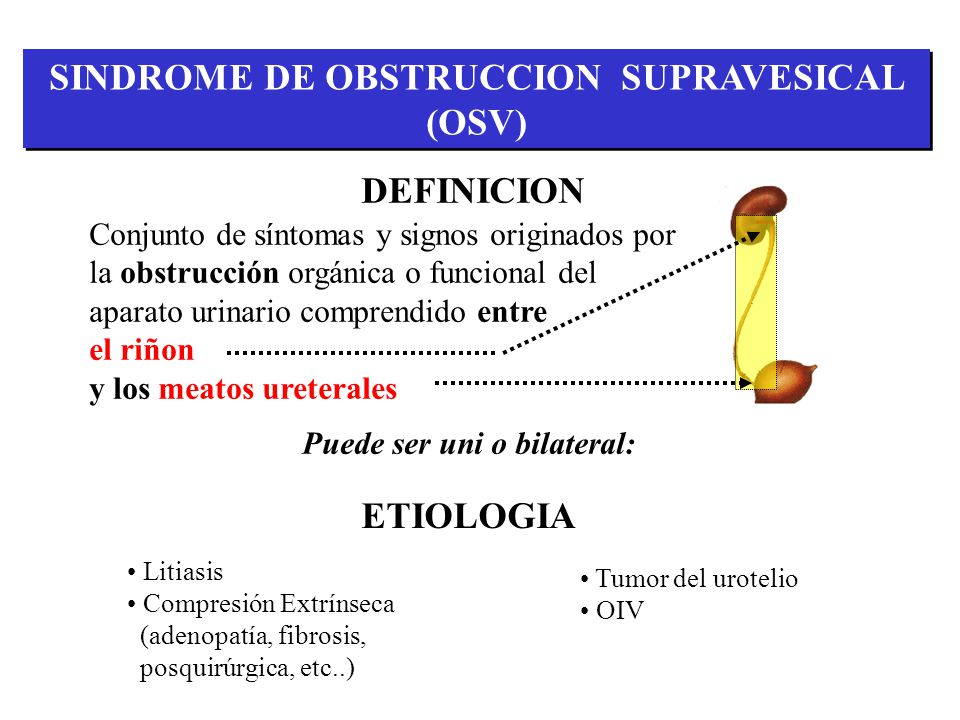 SINDROME DE OBSTRUCCION SUPRAVESICAL (OSV) Puede ser uni o bilateral: