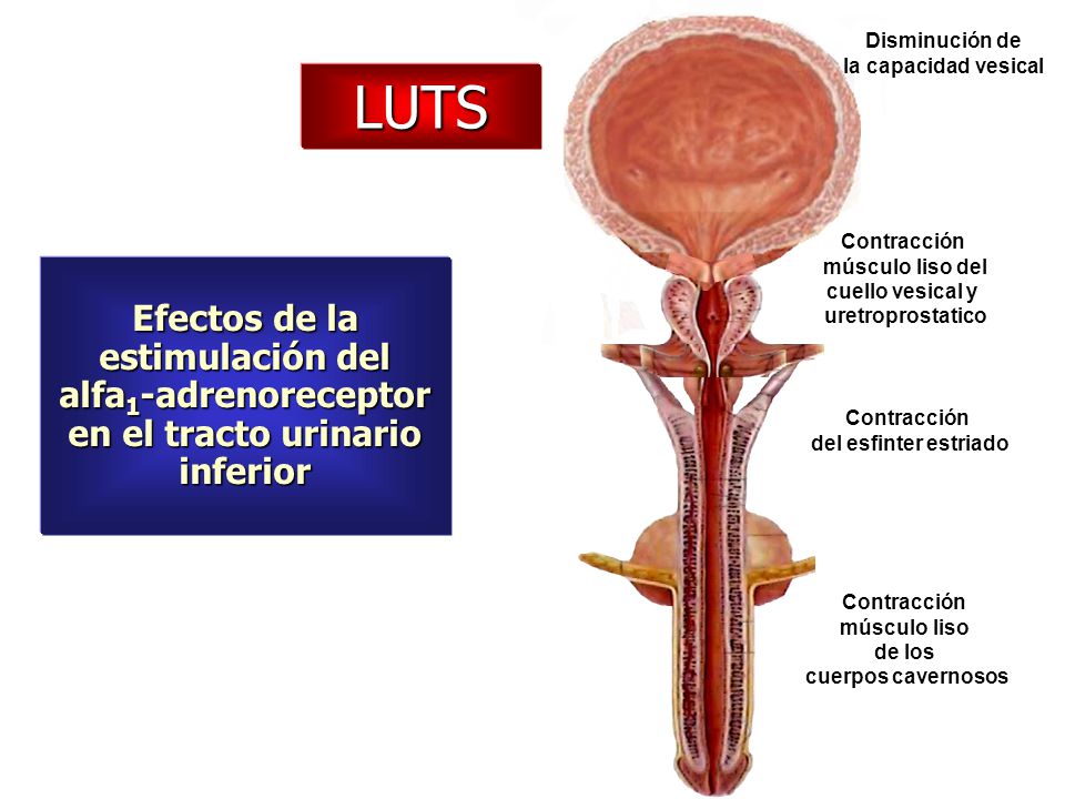Disminución de la capacidad vesical. LUTS. Contracción. músculo liso del. cuello vesical y. uretroprostatico.
