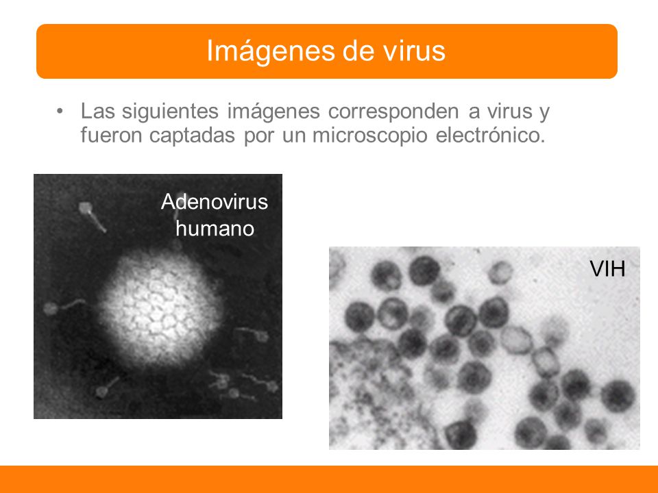 Imágenes de virus Las siguientes imágenes corresponden a virus y fueron captadas por un microscopio electrónico.