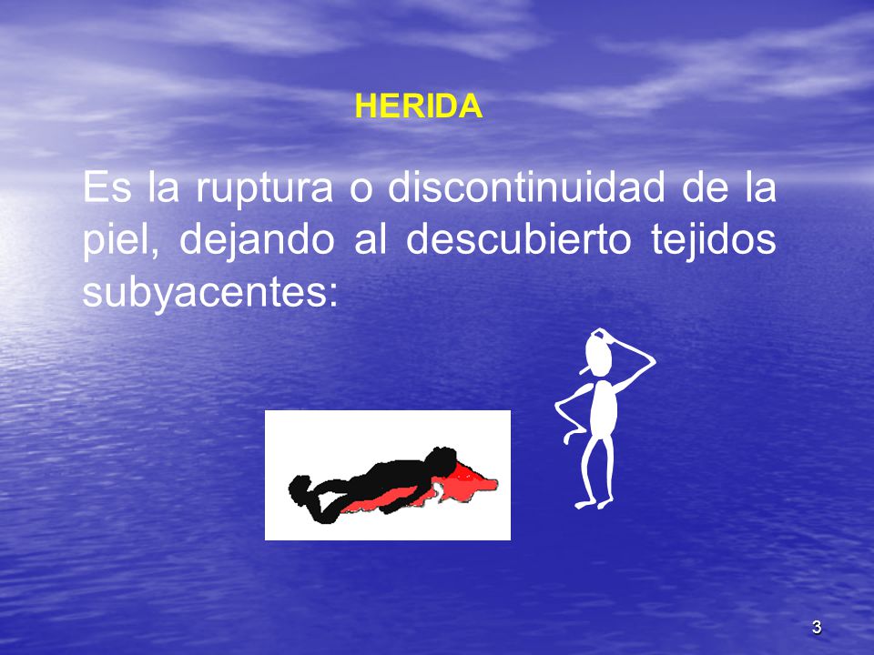 HERIDA Es la ruptura o discontinuidad de la piel, dejando al descubierto tejidos subyacentes: