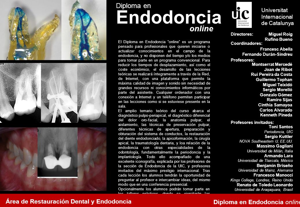 Endodoncia online Diploma en Área de Restauración Dental y Endodoncia