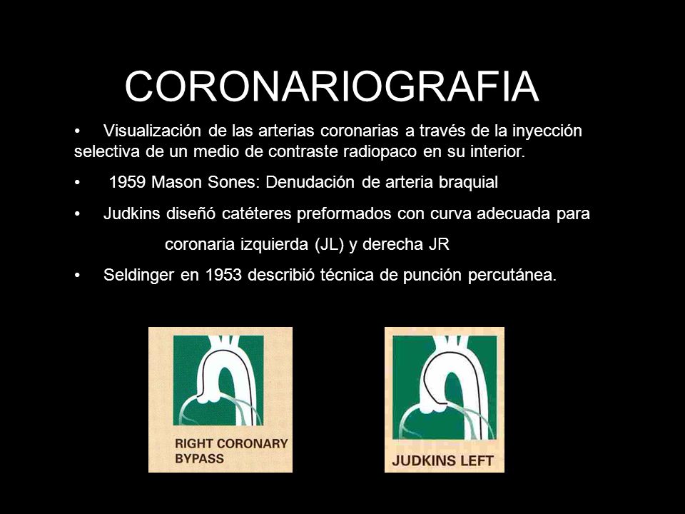 CORONARIOGRAFIA Visualización de las arterias coronarias a través de la inyección selectiva de un medio de contraste radiopaco en su interior.