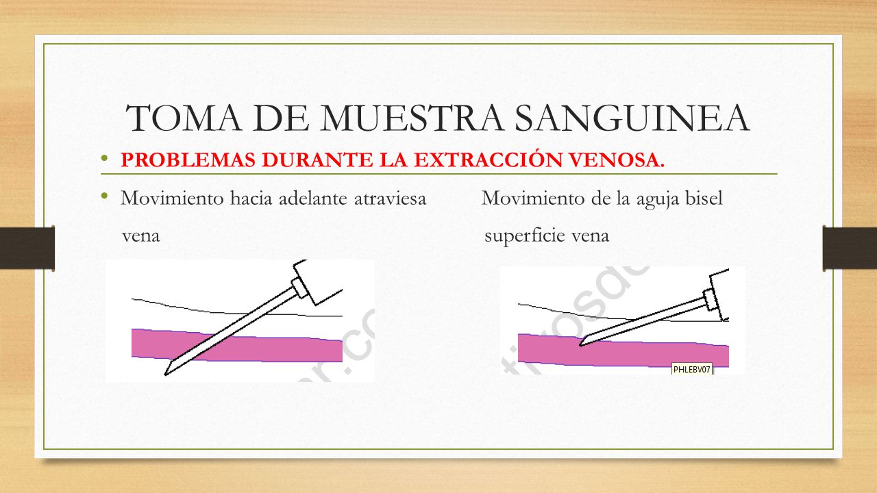 TOMA DE MUESTRA SANGUINEA