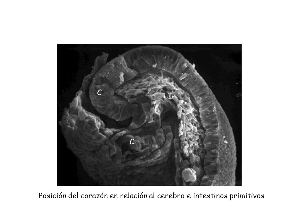 C I C Posición del corazón en relación al cerebro e intestinos primitivos
