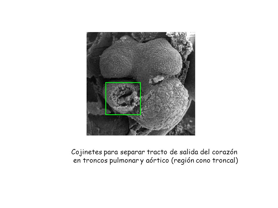 Cojinetes para separar tracto de salida del corazón