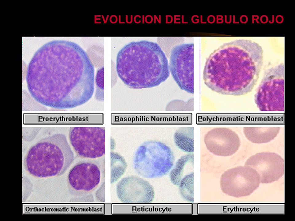 EVOLUCION DEL GLOBULO ROJO