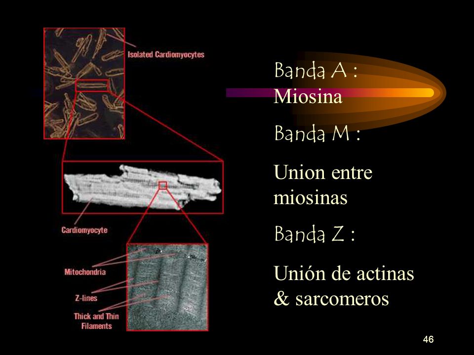 Banda A : Miosina Banda M : Union entre miosinas Banda Z : Unión de actinas & sarcomeros