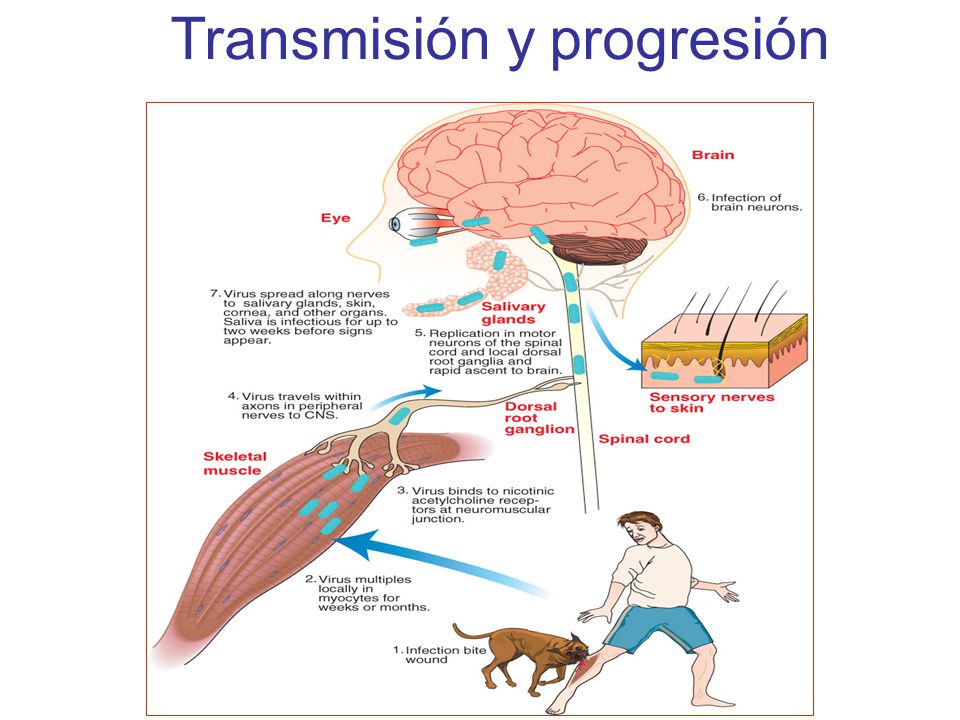 Transmisión y progresión