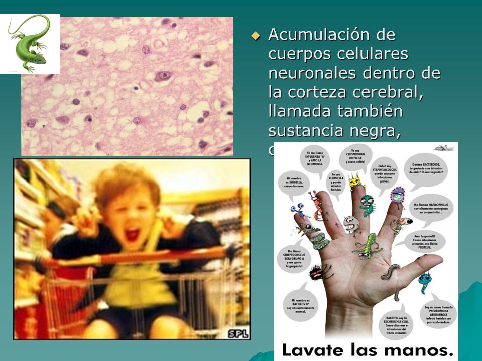 Acumulación de cuerpos celulares neuronales dentro de la corteza cerebral, llamada también sustancia negra, cuerpo gris
