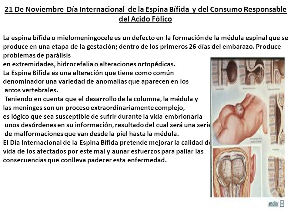 21 De Noviembre Día Internacional de la Espina Bífida y del Consumo Responsable del Acido Fólico