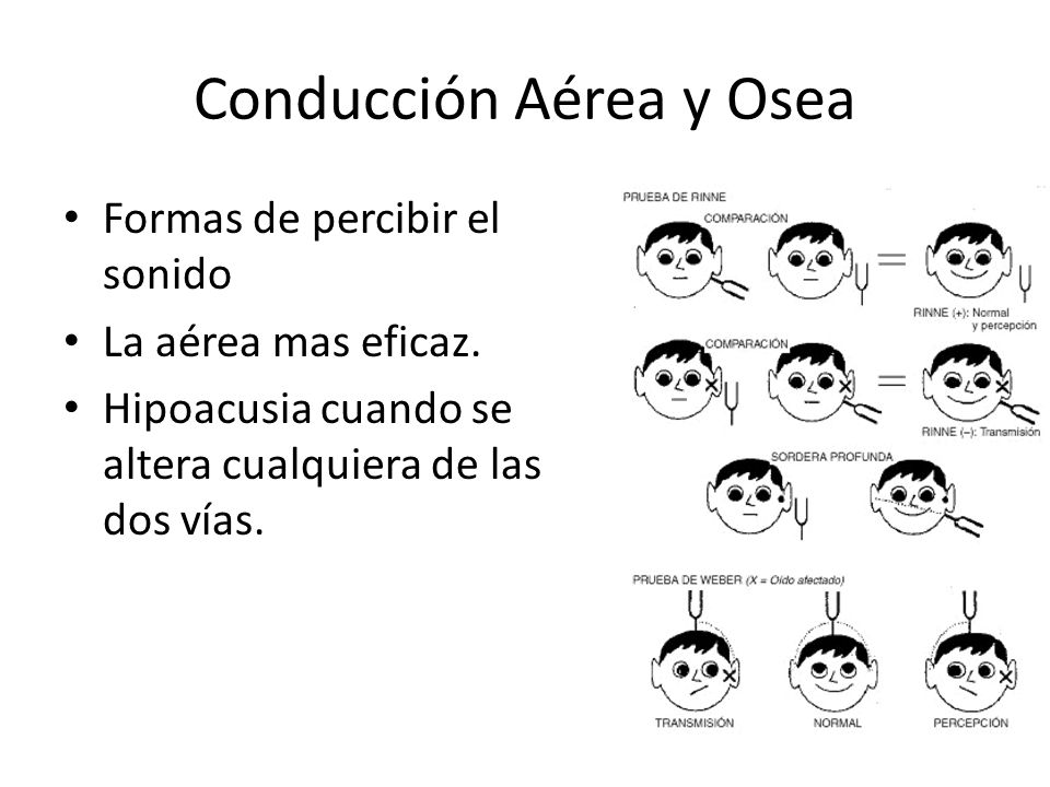 Conducción Aérea y Osea