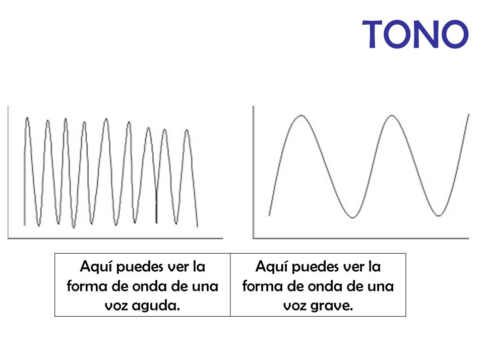 TONO Aquí puedes ver la forma de onda de una voz aguda.