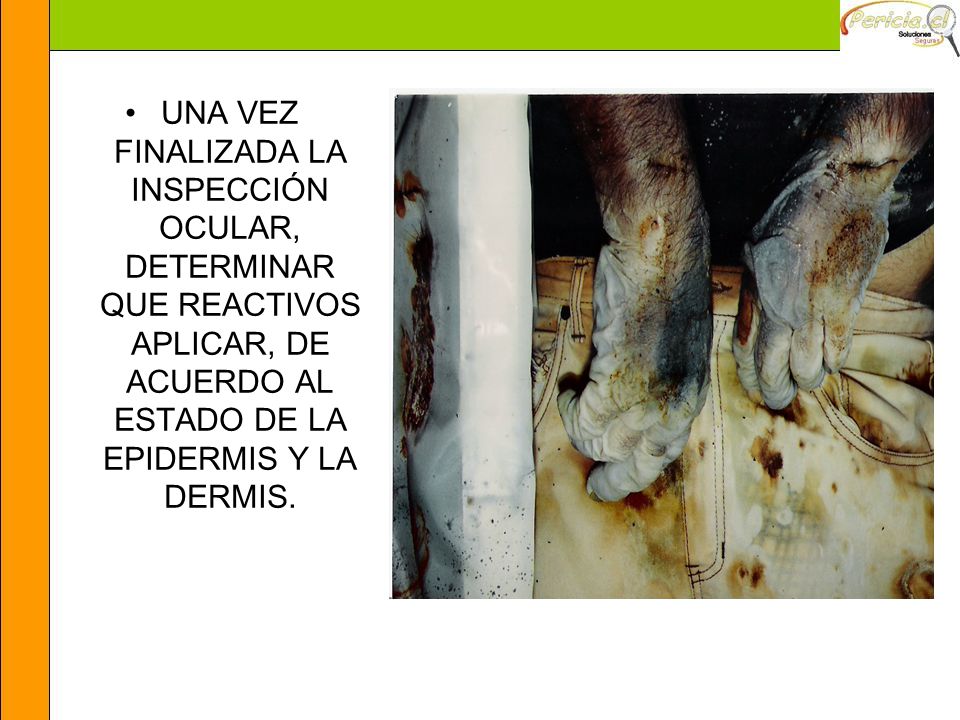 UNA VEZ FINALIZADA LA INSPECCIÓN OCULAR, DETERMINAR QUE REACTIVOS APLICAR, DE ACUERDO AL ESTADO DE LA EPIDERMIS Y LA DERMIS.