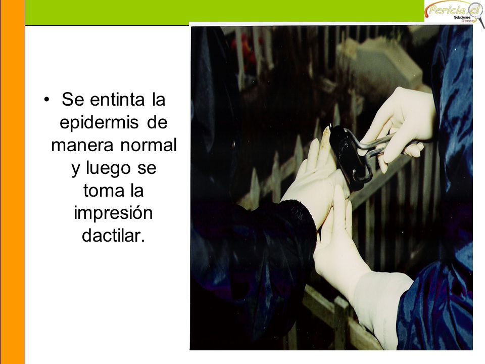 Se entinta la epidermis de manera normal y luego se toma la impresión dactilar.