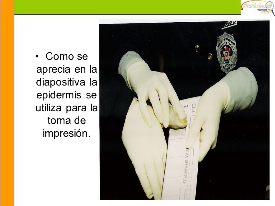 Como se aprecia en la diapositiva la epidermis se utiliza para la toma de impresión.