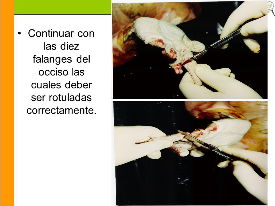 Continuar con las diez falanges del occiso las cuales deber ser rotuladas correctamente.