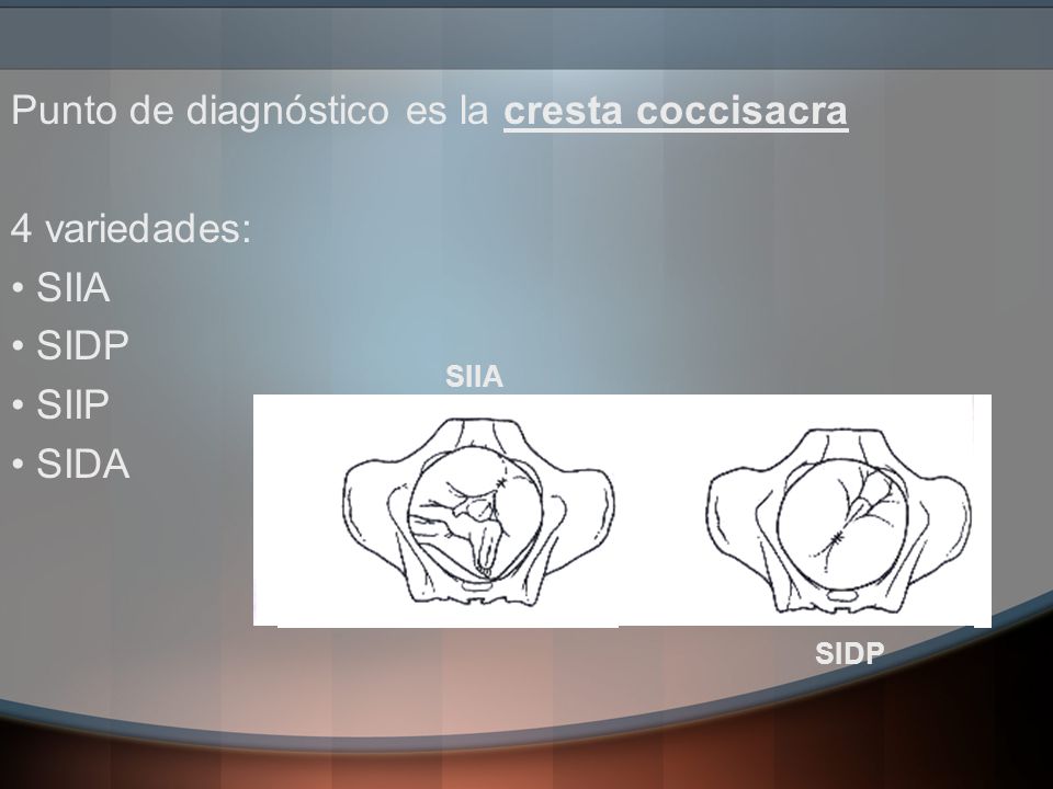 Punto de diagnóstico es la cresta coccisacra 4 variedades: SIIA SIDP
