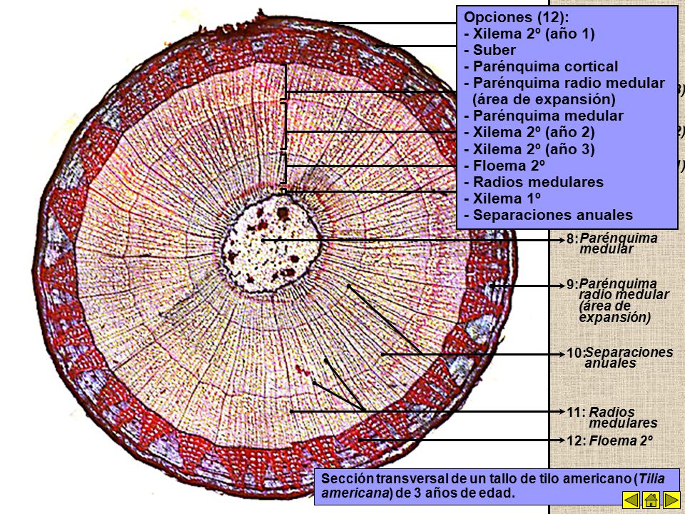 - Parénquima radio medular (área de expansión) - Parénquima medular
