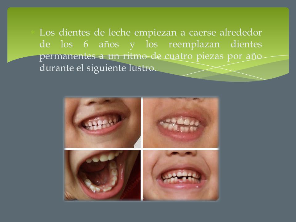 Los dientes de leche empiezan a caerse alrededor de los 6 años y los reemplazan dientes permanentes a un ritmo de cuatro piezas por año durante el siguiente lustro.