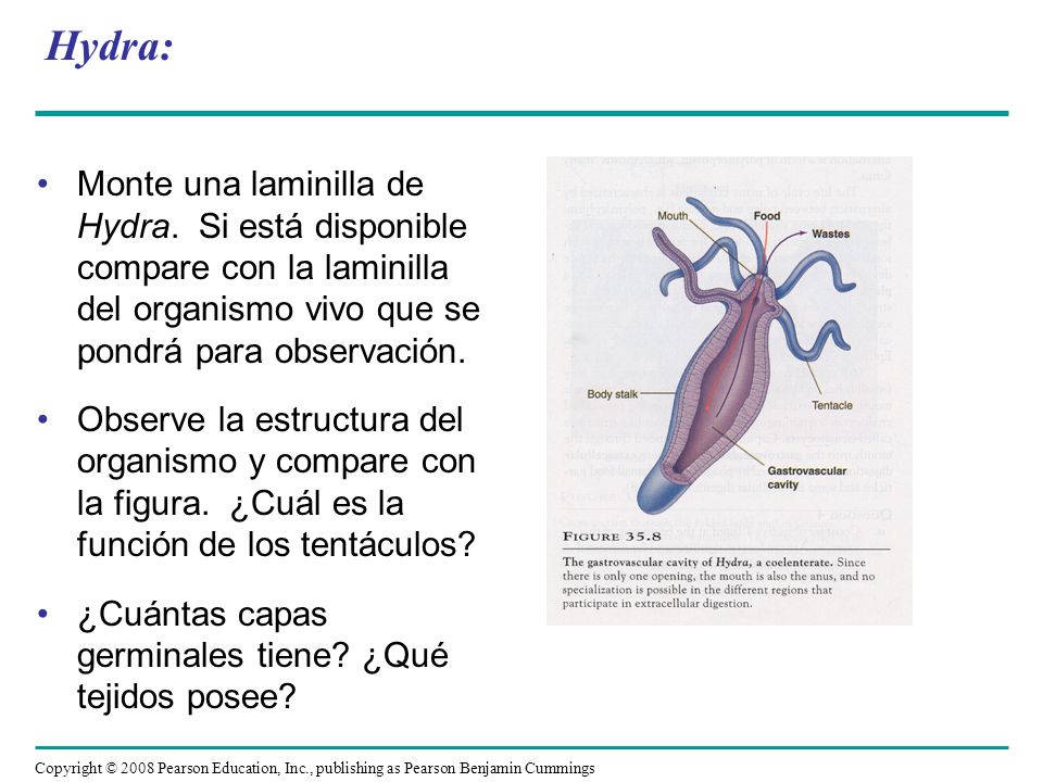 Hydra: Monte una laminilla de Hydra. Si está disponible compare con la laminilla del organismo vivo que se pondrá para observación.