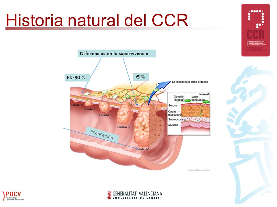 Historia natural del CCR
