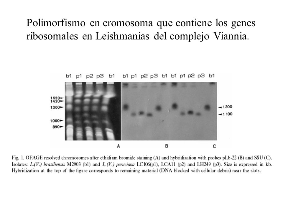 Polimorfismo en cromosoma que contiene los genes ribosomales en Leishmanias del complejo Viannia.