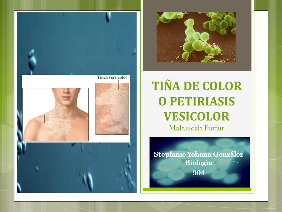 TIÑA DE COLOR O PETIRIASIS VESICOLOR Malassezia Furfur
